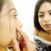 ব্রণের সমস্যায় অদ্ভুত সমাধান
