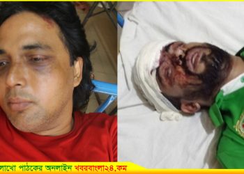 কালিহাতীতে ইউনিয়ন আ’লীগের বর্ধিত সভায় দুইগ্রুপের সংঘর্ষ, আহত ৬
