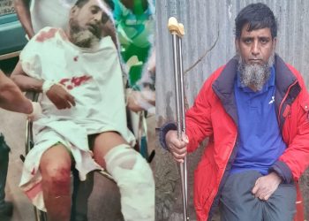 আহত সিএনজি চালক সুজন ও তার শরীরে পুলিশের ছররা গু'লি।