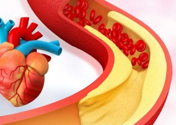 উচ্চ কোলেস্টেরল নিয়ন্ত্রণে রাখুন: যেসব খাবার এড়িয়ে চলা জরুরি