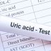ইউরিক এসিড নিয়ন্ত্রণে মেনে চলা জরুরি যেসব নিয়ম