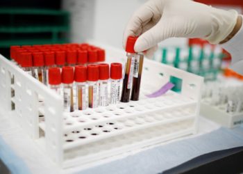 একটি রক্ত পরীক্ষায় শনাক্ত হতে পারে ৫০ ধরনের ক্যান্সার