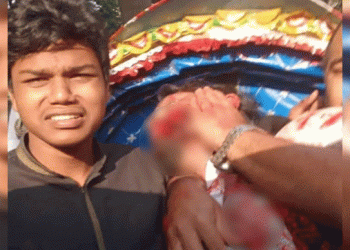 ওসমান হাদির অবস্থা সম্পর্কে যা জানালেন চিকিৎসক