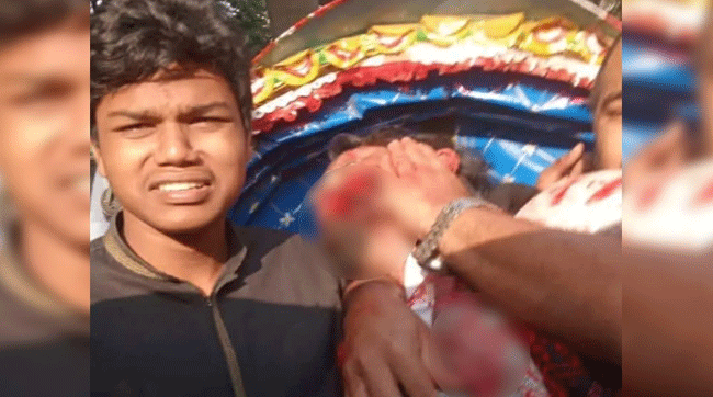 ওসমান হাদির অবস্থা সম্পর্কে যা জানালেন চিকিৎসক