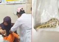 রাসেল ভাইপারের কামড়ে আহত শিশু, সাপসহ হাসপাতালে স্বজনরা
