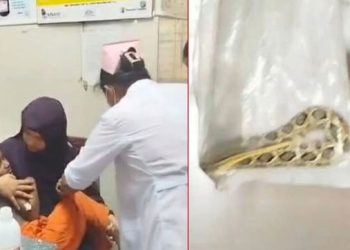 রাসেল ভাইপারের কামড়ে আহত শিশু, সাপসহ হাসপাতালে স্বজনরা