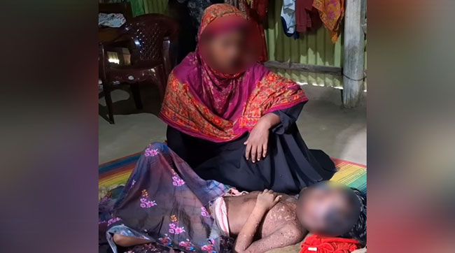 সখীপুরে লুপাস নেফ্রাইটিসে আক্রান্ত স্কুলছাত্রীর মৃত্যু